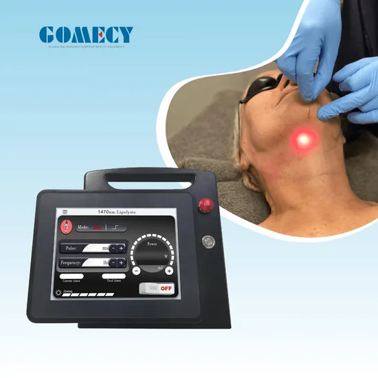 Portable Vaser Liposuction Diode Laser 980nm 1470nm Lipolysis Machine Body Slimming for Sale 