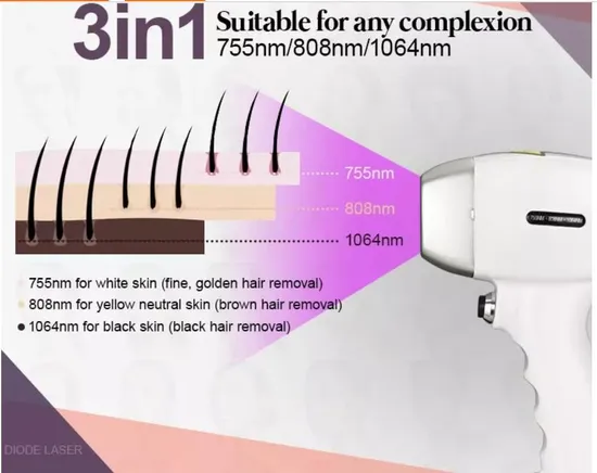 FDA Approved Medical Grade Ice Laser Manufacturer with 808 755 1064 Permanent Hair Removal 