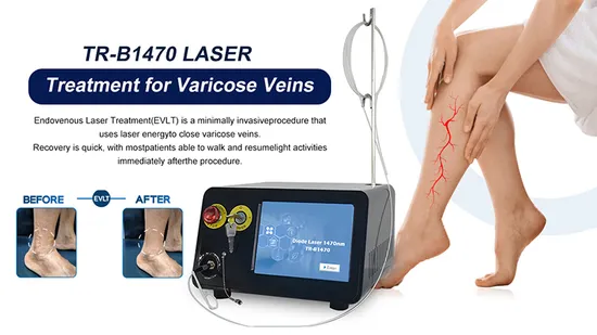 Portable Evlt/Evla Diode Laser 980nm 1470nm for Endovenous Laser Varicose Vein Treatment Machine 